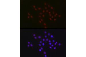 Immunofluorescence analysis of PC-12 cells using USP39 Rabbit mAb (ABIN7271160) at dilution of 1:100 (40x lens). (USP39 Antikörper)