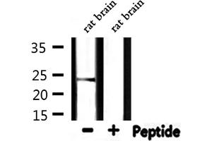 Western blot analysis of extracts from rat brain, using HSPB2 Antibody. (HSPB2 Antikörper  (Internal Region))