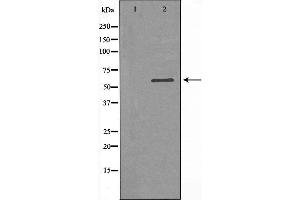 Western blot analysis of extracts from K562 cells, using SLC16A2 antibody. (SLC16A2/MCT8 Antikörper  (Internal Region))