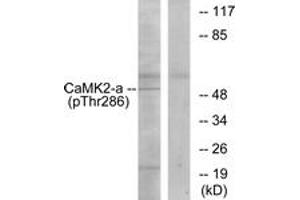 Western blot analysis of extracts from K562 cells, using CaMK2 (Phospho-Thr286) Antibody. (CAMK2B Antikörper  (pThr286))