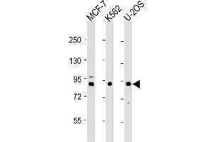 Western Blotting (WB) image for anti-Procollagen-Lysine,2-Oxoglutarate 5-Dioxygenase 1 (PLOD1) (AA 66-94), (N-Term) antibody (ABIN656585)