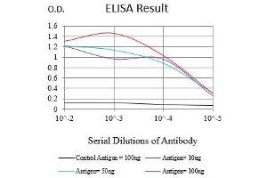 Black line: Control Antigen (100 ng),Purple line: Antigen (10 ng), Blue line: Antigen (50 ng), Red line:Antigen (100 ng) (KRT6A Antikörper  (AA 253-352))