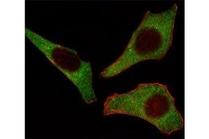 Fluorescent image of HeLa cells stained with CDK4 antibody at 1:25. (CDK4 Antikörper  (AA 273-305))