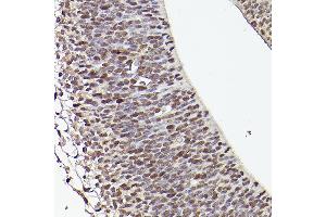 Immunohistochemistry of paraffin-embedded mouse fetal Brain using TET1 Rabbit pAb (ABIN3022030, ABIN3022031, ABIN3022032, ABIN1513597 and ABIN6218576) at dilution of 1:50 (40x lens). (TET1 Antikörper)
