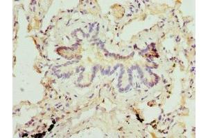 Immunohistochemistry of paraffin-embedded human lung tissue using ABIN7159380 at dilution of 1:100 (MBTPS1 Antikörper  (AA 803-1052))