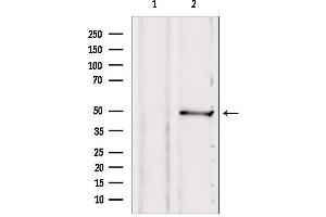 Western blot analysis of extracts from 293, using SUCLA2 antibody. (SUCLA2 Antikörper  (Internal Region))