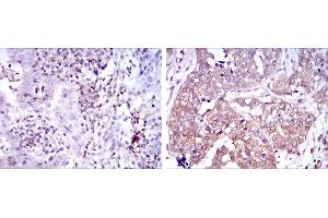 Immunohistochemistry (IHC) image for anti-Nuclear Factor of kappa Light Polypeptide Gene Enhancer in B-Cells 1 (NFKB1) antibody (ABIN969313)