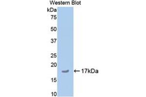Western blot analysis of the recombinant protein. (COMP Antikörper  (AA 35-179))