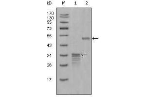 Western Blot showing Mammaglobin-1 antibody used against full-length GST- Mammaglobin-1 (1) and full-length MBP- Mammaglobin-1 (aa1-193) recombinant protein (2). (Mammaglobin A Antikörper  (AA 1-193))