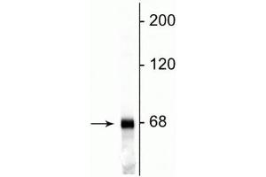 Western blot of rat cortical lysate showing specific immunolabeling of the ~68 kDa NF-L protein. (NEFL Antikörper)