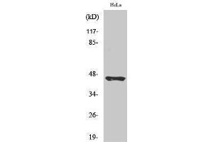 Western Blotting (WB) image for anti-Plasma Kallikrein HC (Arg390), (cleaved) antibody (ABIN3181850) (Plasma Kallikrein HC (Arg390), (cleaved) Antikörper)