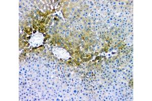 IHC analysis of RMI2 using anti-RMI2 antibody (ABIN6719656).
