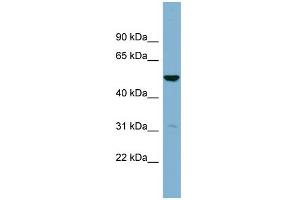 WB Suggested Anti-SDSL Antibody Titration:  0. (SDSL Antikörper  (Middle Region))