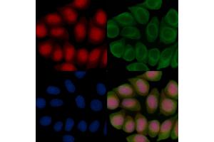 ABIN7096729 and ABIN7100794 staining Hela cells(45 min of heat-shock treatment) by IF/ICC. (ZNF382 Antikörper)