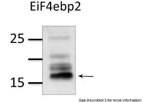 Sample Type: mouse brain extract (50ug)Primary Dilution: 1:1000Image Submitted by: Veronique DorvalLaval University, Canada . (eIF4EBP2 Antikörper  (N-Term))