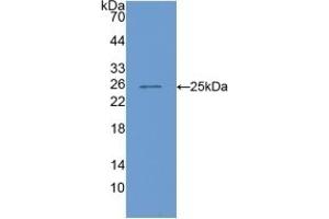 Detection of Recombinant COMP, Mouse using Polyclonal Antibody to Cartilage Oligomeric Matrix Protein (COMP) (COMP Antikörper  (AA 554-753))