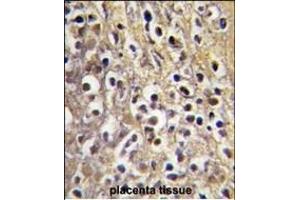 Formalin-fixed and paraffin-embedded human placenta tissue reacted with CYP19A1 antibody (C-term) (ABIN391826 and ABIN2841671) , which was peroxidase-conjugated to the secondary antibody, followed by DAB staining. (Aromatase Antikörper  (C-Term))