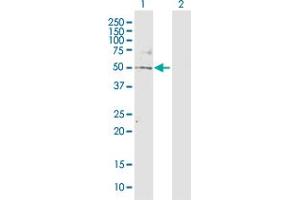 Western Blot analysis of TBL2 expression in transfected 293T cell line by TBL2 MaxPab polyclonal antibody. (TBL2 Antikörper  (AA 1-447))