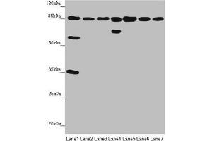 Western blot All lanes: NELL1 antibody at 3. (NELL1 Antikörper  (AA 160-420))