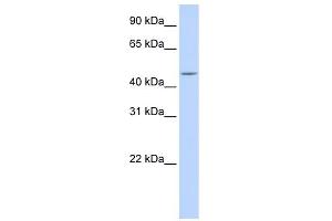 WB Suggested Anti-CPE Antibody Titration: 0. (CPE Antikörper  (N-Term))