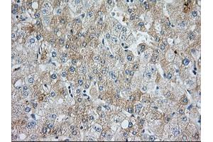 Immunohistochemical staining of paraffin-embedded Human liver tissue using anti-BIRC5 mouse monoclonal antibody. (Survivin Antikörper)