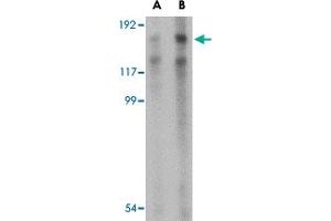 Western blot analysis of TARBP1 in NIH/3T3 cell lysate with TARBP1 polyclonal antibody  at (A) 1 and (B) 2 ug/mL . (TARBP1 Antikörper  (Internal Region))