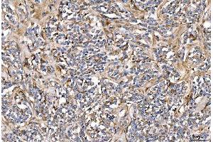 IHC analysis of Alpha 2 Antiplasmin/SERPINF2 using anti-Alpha 2 Antiplasmin/SERPINF2 antibody (ABIN7601808).