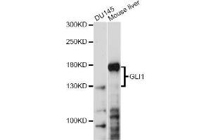 Western blot analysis of extracts of various cell lines, using GLI1 antibody. (GLI1 Antikörper)