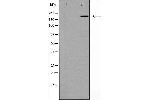 Western blot analysis of ZO 1 expression in Human brain,The lane on the left is treated with the antigen-specific peptide. (TJP1 Antikörper)