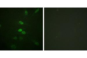 Peptide - +Immunofluorescence analysis of HeLa cells, using CDC25B (Ab-353) antibody. (CDC25B Antikörper  (Ser353))