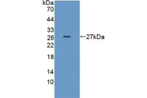 Western blot analysis of recombinant Human TPMT. (TPMT Antikörper  (AA 26-227))