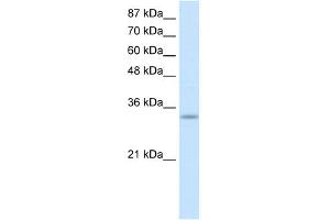 Western Blotting (WB) image for anti-Protein Kinase, Interferon-Inducible Double Stranded RNA Dependent Activator (PRKRA) (Middle Region) antibody (ABIN2778859)