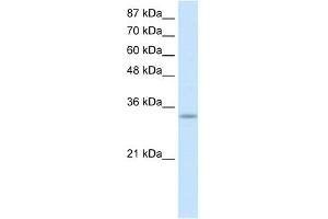 WB Suggested Anti-PRKRA Antibody Titration:  0. (PRKRA Antikörper  (Middle Region))