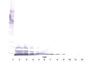 Image no. 4 for anti-Chemokine (C-X-C Motif) Ligand 14 (CXCL14) antibody (ABIN465240) (CXCL14 Antikörper)