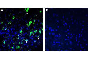 Expression of SORCS1 in mouse deep cerebellar nuclei.