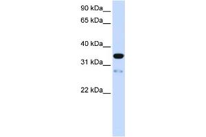 WB Suggested Anti-TMEM38A Antibody Titration:  0. (TMEM38A Antikörper  (N-Term))