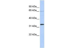 WB Suggested Anti-GRHL2 Antibody Titration:  1 ug/ml  Positive Control:  721_B cell lysate (GRHL2 Antikörper  (Middle Region))