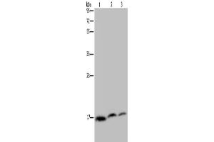 Western Blotting (WB) image for anti-NADH Dehydrogenase (Ubiquinone) 1 alpha Subcomplex, Assembly Factor 4 (NDUFAF4) antibody (ABIN2433437) (NDUFAF4 Antikörper)