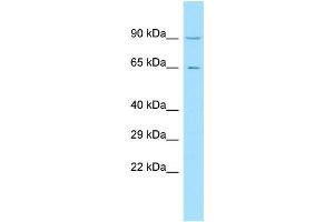WB Suggested Anti-C11orf2 Antibody Titration: 1. (VPS51 Antikörper  (C-Term))