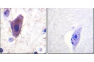 Immunohistochemistry analysis of paraffin-embedded human brain tissue, using CD71/TfR (Ab-24) Antibody.