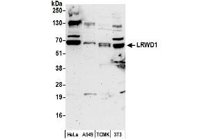 Western Blotting (WB) image for anti-Leucine-Rich Repeat and WD Repeat-Containing Protein 1 (LRWD1) (AA 432-482) antibody (ABIN7452893)
