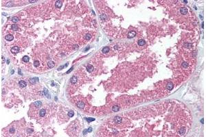 Human Kidney (formalin-fixed, paraffin-embedded) stained with AADAT antibody ABIN239800 at 2. (AADAT Antikörper  (N-Term))