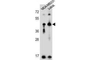 Western Blotting (WB) image for anti-Killer Cell Immunoglobulin-Like Receptor, Two Domains, Long Cytoplasmic Tail, 2 (KIR2DL2) antibody (ABIN3002433) (KIR2DL2 Antikörper)
