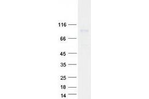 Validation with Western Blot