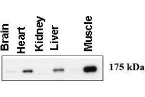 Western blot using anti-AGL antibody at 1:1000 dilution. (AGL Antikörper  (C-Term))