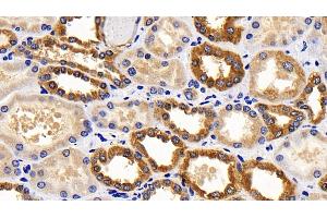 Immunohistochemistry (IHC) image for anti-Cytochrome C, Somatic (CYCS) (AA 13-99) antibody (ABIN7440230)