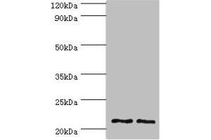 Western blot All lanes: DNAL1 antibody at 4 μg/mL Lane 1: Hela whole cell lysate Lane 2: HepG2 whole cell lysate Secondary Goat polyclonal to rabbit IgG at 1/10000 dilution Predicted band size: 22, 9, 18 kDa Observed band size: 22 kDa (DNAL1 Antikörper  (AA 41-190))