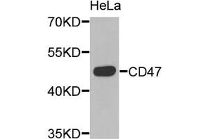 Western blot analysis of extracts of HeLa cells, using CD47 antibody. (CD47 Antikörper)