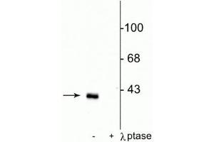 Western blot of rat striatal lysate showing specific immunolabeling of the ~32 kDa DARPP-32 phosphorylated at Thr75 in the first lane (-). (DARPP32 Antikörper  (pThr75))