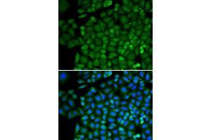 Immunofluorescence analysis of HeLa cells using SELENBP1 antibody (ABIN3021766, ABIN3021767, ABIN3021768 and ABIN1513508).